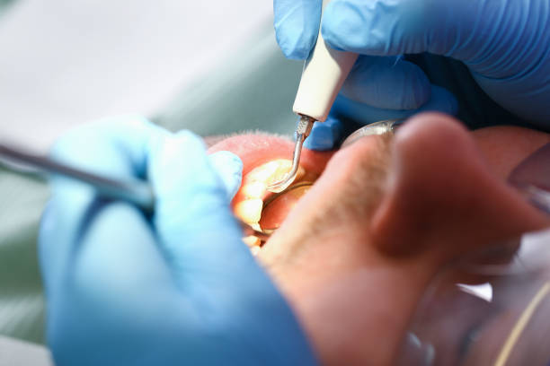 Best Emergency Denture Repair in Port Ludlow, WA